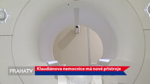 Klaudiánova nemocnice má nové přístroje
