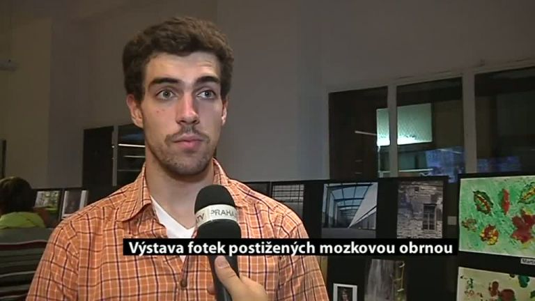 Výstava fotek postižených mozkovou obrnou