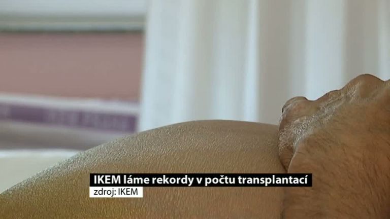 IKEM láme rekordy v počtu transplantací