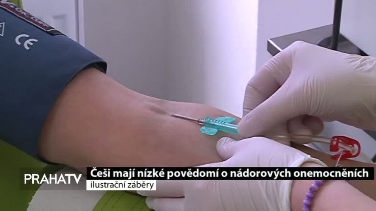 Češi mají nízké povědomí o nádorových onemocněních