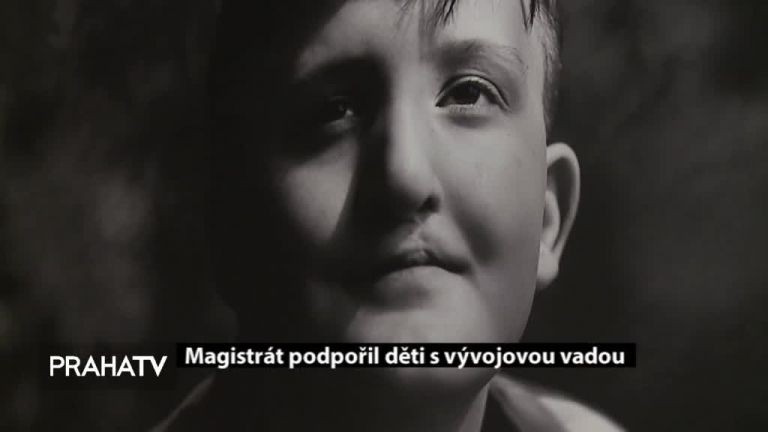 Magistrát podpořil děti s vývojovou vadou